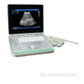 SS-9 Sonostar tragbarer Laptop-Ultraschallscanner